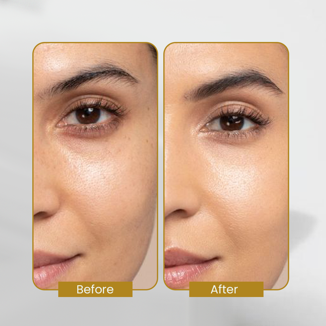 Niacinamide Serum