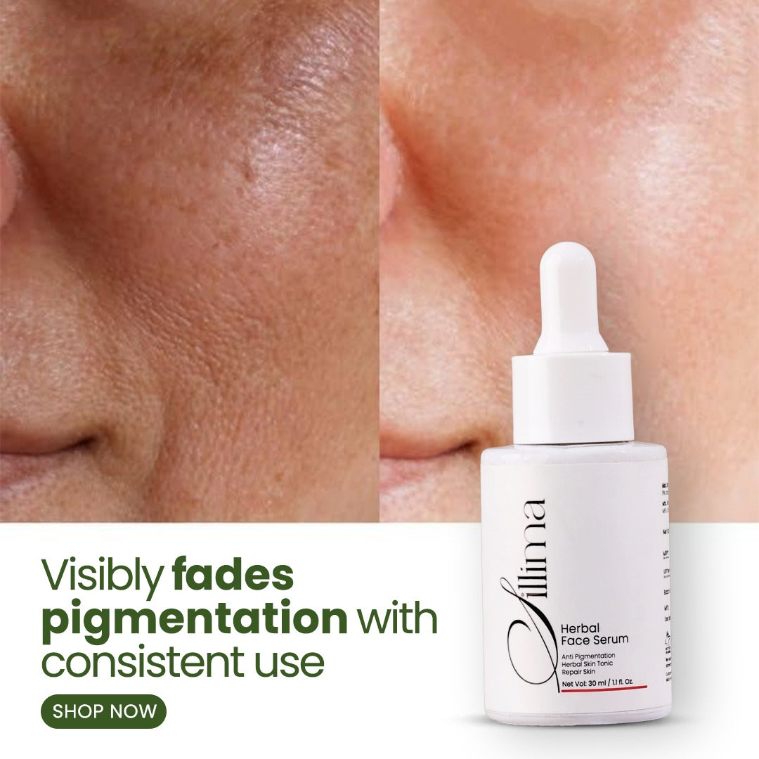 Advanced Pigmentation & Acne Herbal Face Serum - Sillima