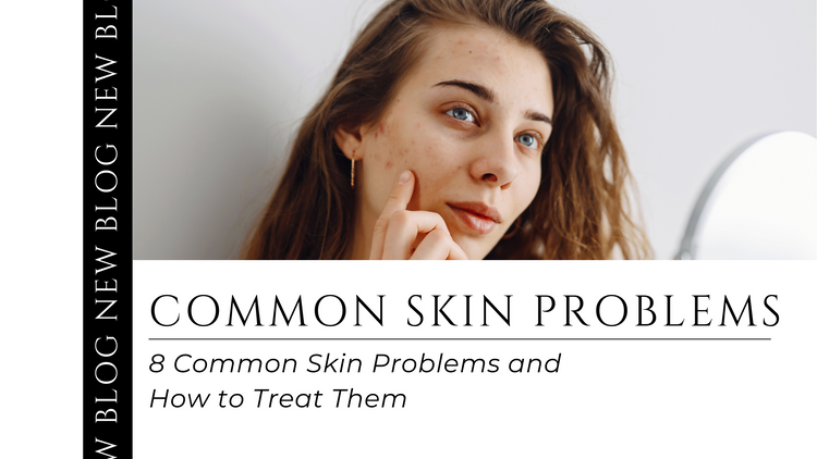 8 Common Skin Problems and How to Treat Them – Sillima