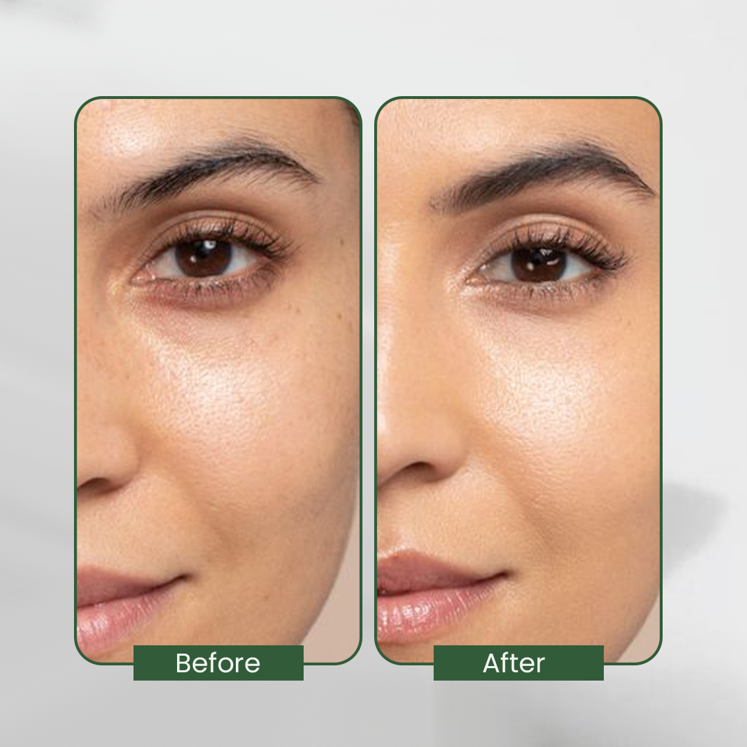 Herbal Face Serum